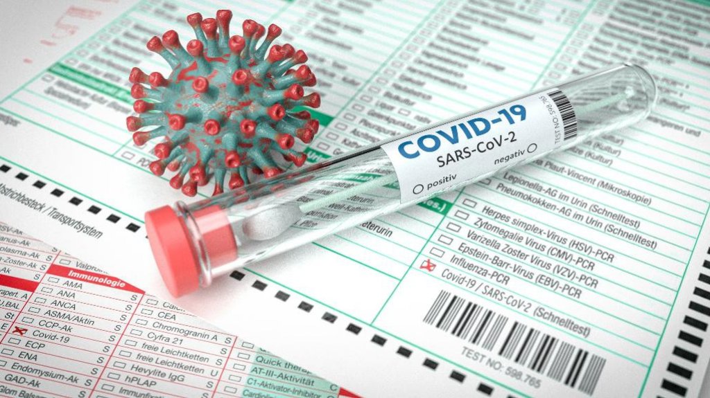  112 casos positivos de COVID-19 en Informe DS 