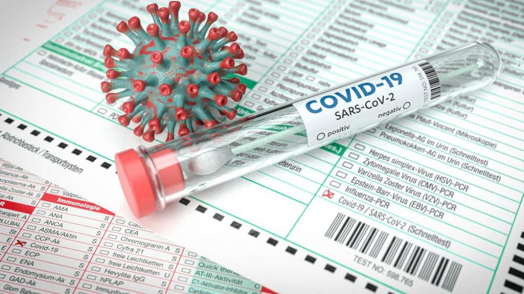  Cinco nuevas muertes por Covid-19, mientras que hospitalizados aumentan a 140, entre ellos 23 pediátricos 