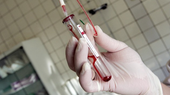 Segundo bebÃ© posiblemente 'curado' de VIH