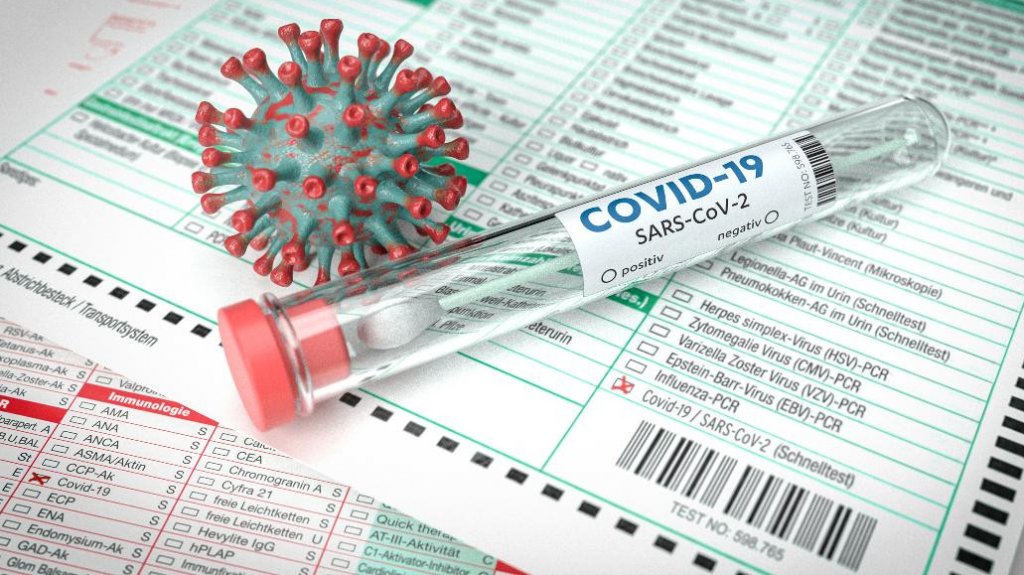  Salud reporta cuatro muertes y 195 hospitalizaciones 