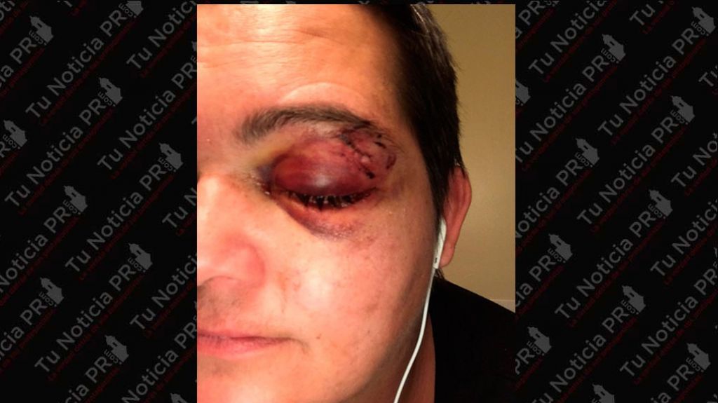  Fotos: La fot&oacute;grafa que perdi&oacute; un ojo en las protestas: La violencia es sist&eacute;mica 