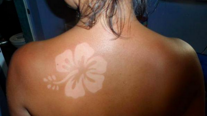 #SunBurnArt: la peligrosa tendencia del verano