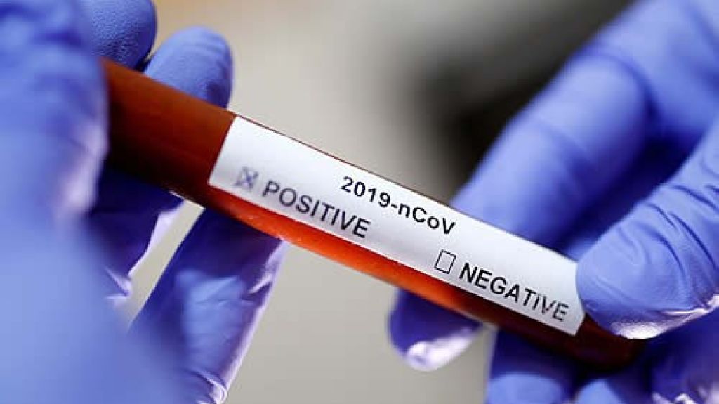  Salud confirma aumento a 8 casos positivos a COVID-19 