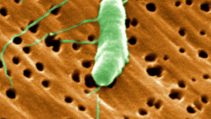 Una bacteria 'devoracarne' se cobra su tercera vÃ­ctima mortal este aÃ±o en EE.UU.