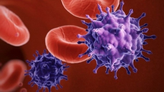 Una nueva cepa del VIH conduce a un desarrollo mÃ¡s rÃ¡pido del SIDA