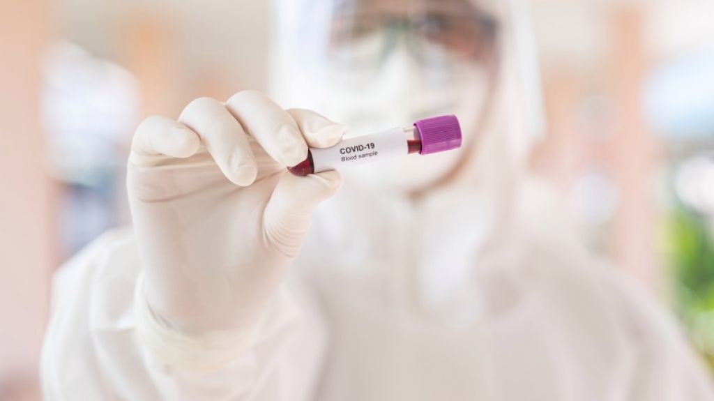  Suman 79 el total de casos positivos por Covid-19 