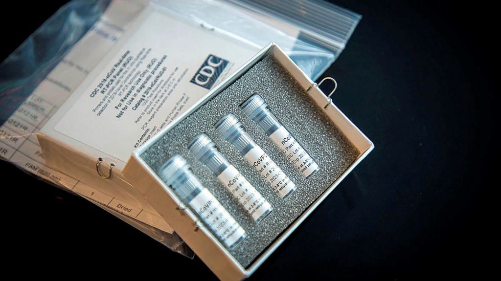  Detectan segundo infectado de coronavirus en EE.UU. sin haber salido del pa&iacute;s 