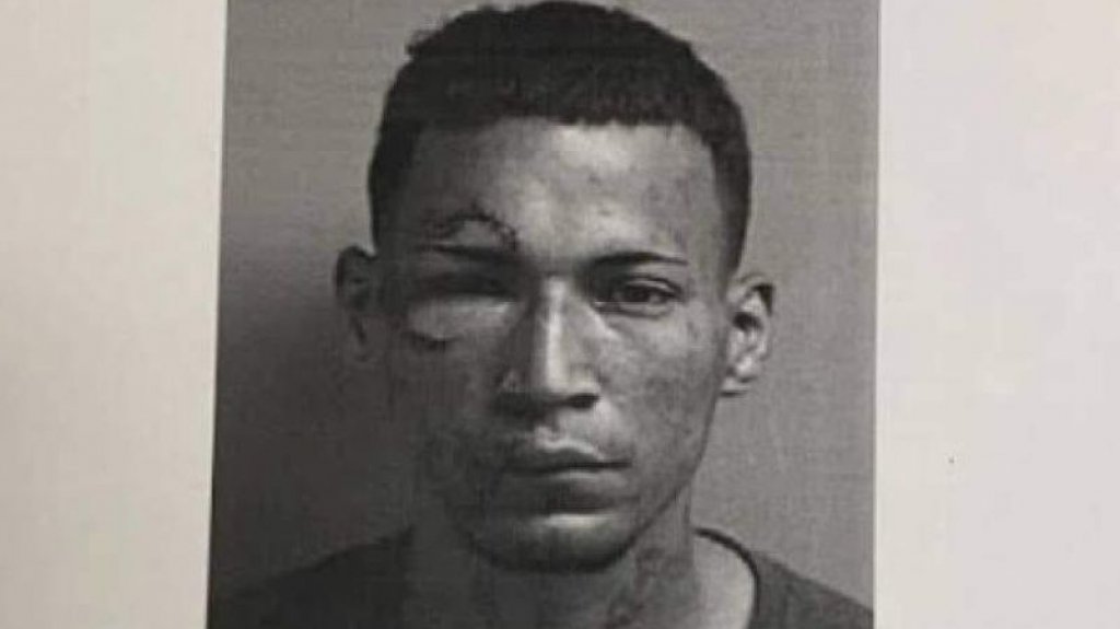  Rob&oacute; en Walgreen de Caguas y se le puso guapo a la polic&iacute;a, luego &ldquo;se tropez&oacute;&rdquo; y termino con un ojo y bembe hinchado 