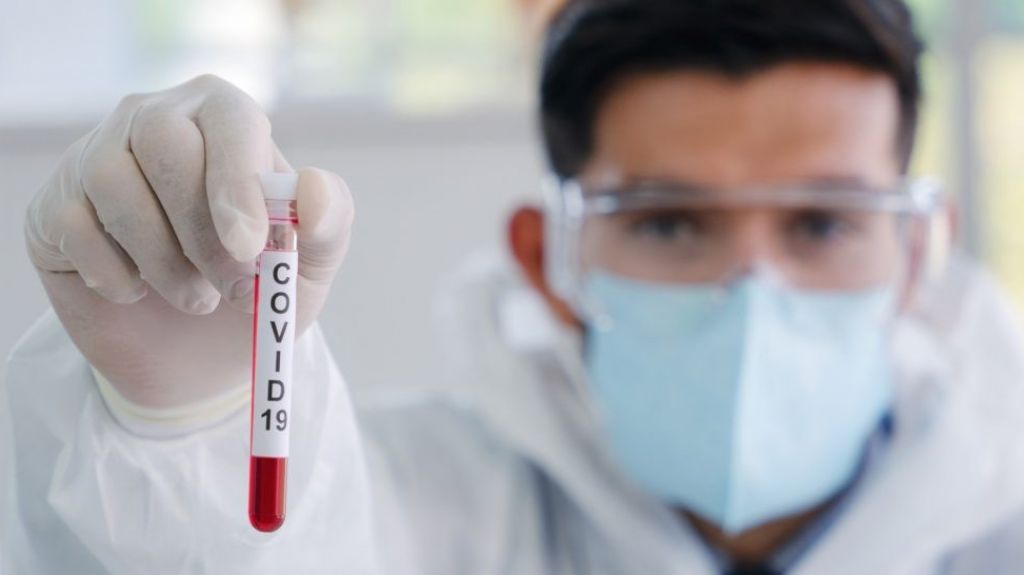  Coronavirus/Aumentan de 34 a 72 los casos en el país 