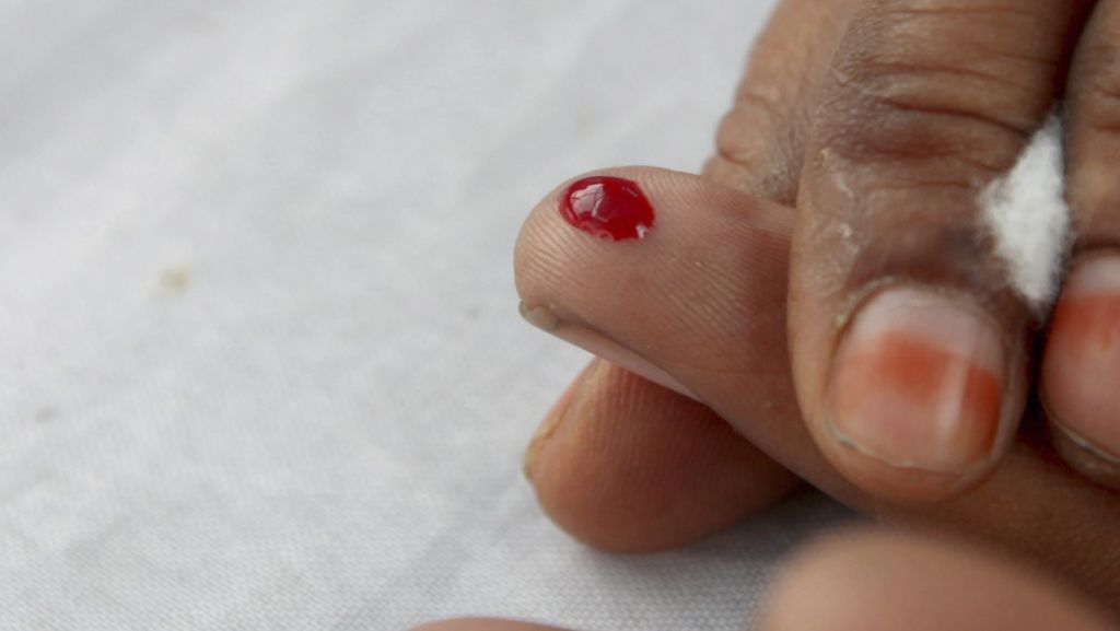  La diabetes es la tercera causa de muerte en Puerto Rico 