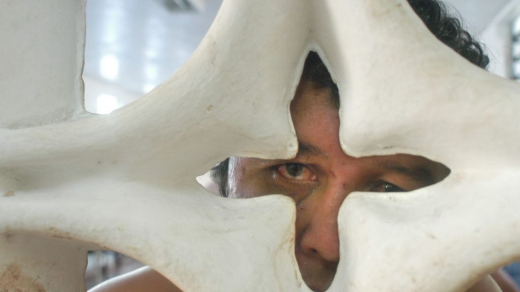  Invierten 3,5 millones de d&oacute;lares en mejoras a centros de psiquiatr&iacute;a 