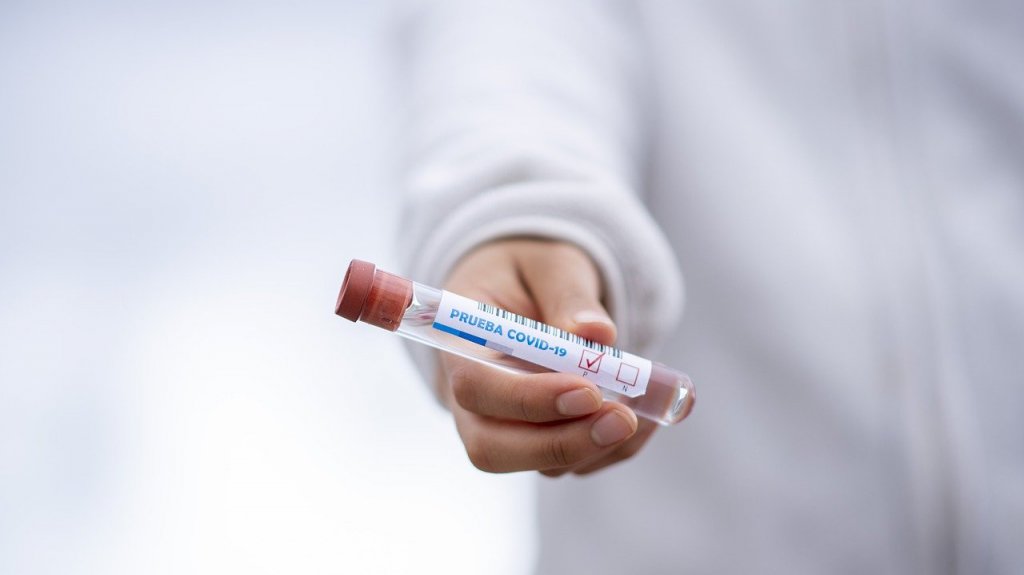  Tasa de positividad por COVID-19 está en 34.36% según Salud 