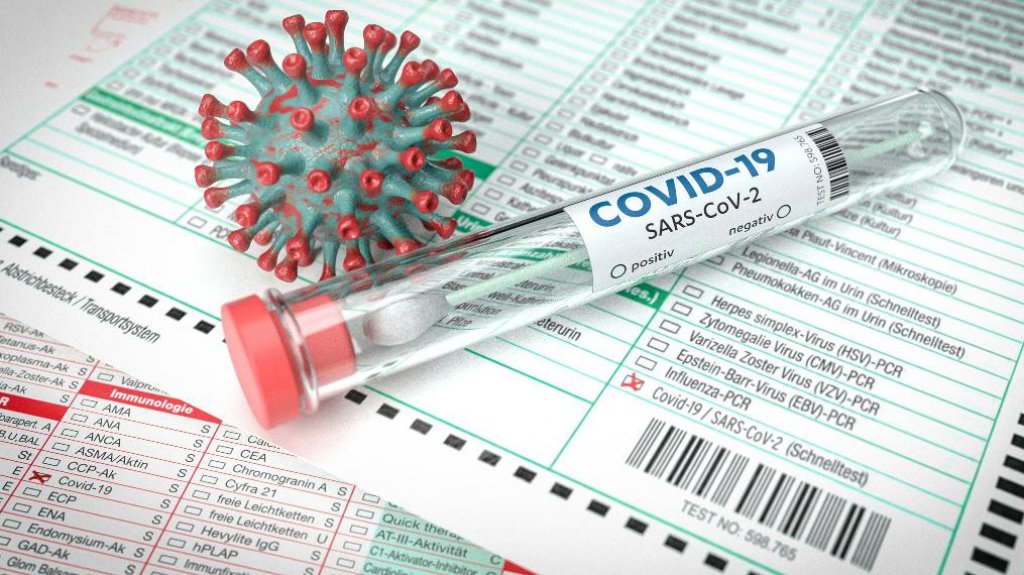  Salud reporta otras cinco muertes y 453 hospitalizaciones por COVID-19 