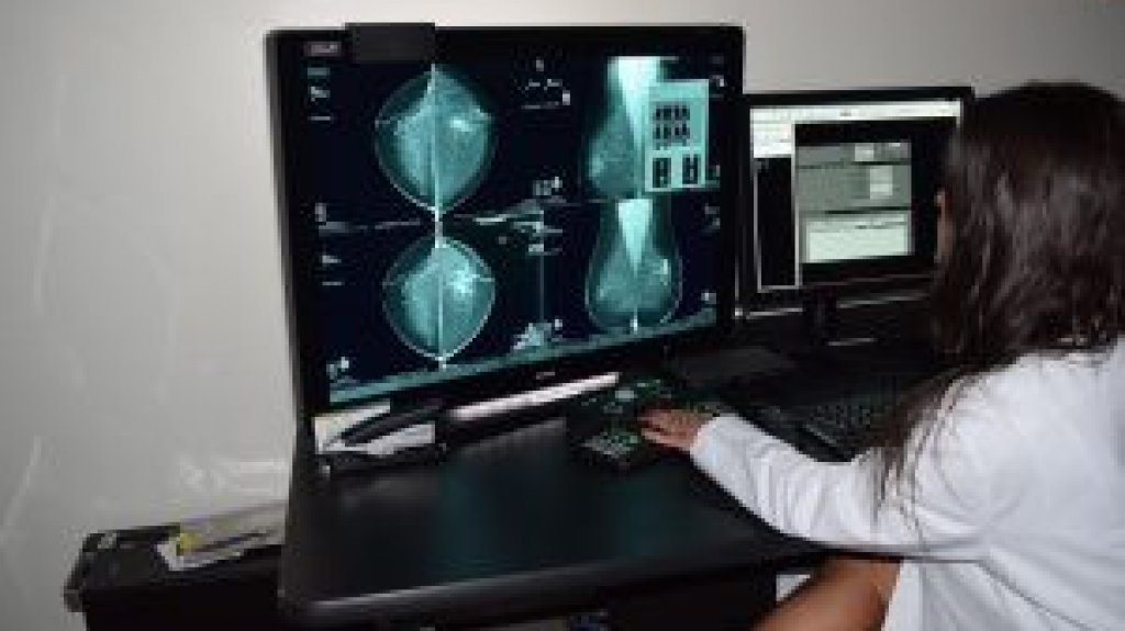  Más de dos mil mujeres son diagnosticadas anualmente en la Isla con cáncer de seno invasivo, ante lo cual aconsejan tecnología avanzada para un diagnóstico preciso 