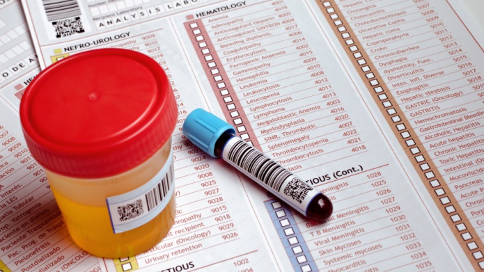 QuÃ© nos dice el color de la orina sobre nuestra salud