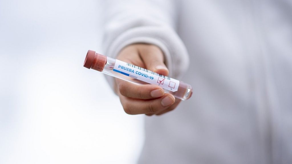  Salud entrega pruebas de COVID-19 a Laboratorios Cl&iacute;nicos de la Comunidad 