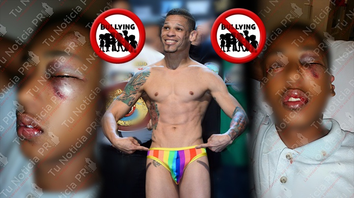 Pupilo del boxeador Orlando Fenómeno Cruz, destroza la cara de un menor de 16 años en San German
