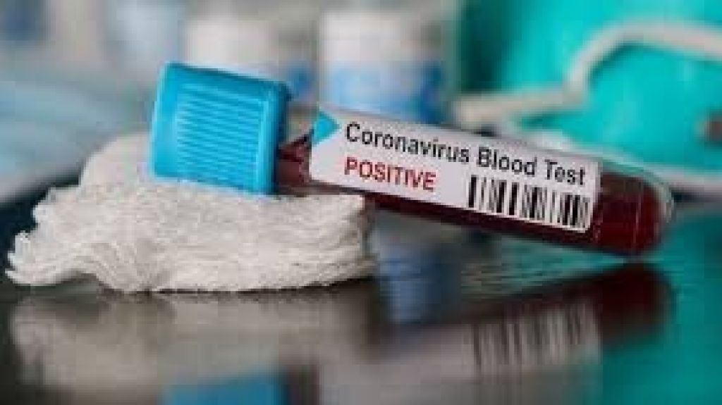  Aumentan a 20 las muertes por COVID-19 en la Isla 