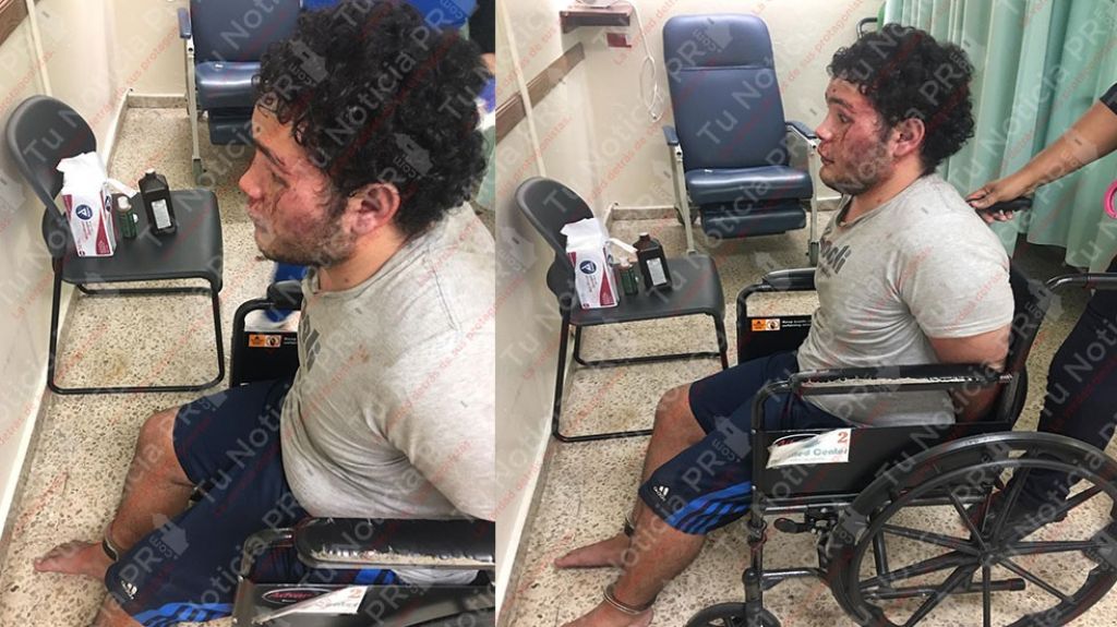  Video: Hace dos d&iacute;as apu&ntilde;al&oacute; a su madre en Trujillo Alto, hoy lleg&oacute; con la cara &ldquo;rota y llena de Sangre&rdquo; a un hospital 