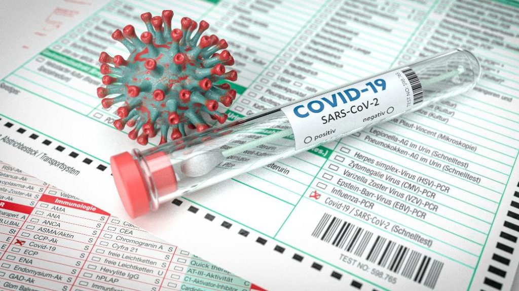  7 muertos y 431 casos confirmados de COVID-19 en informe DS 