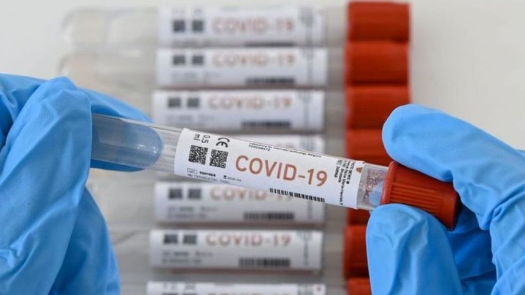  Salud informa que laboratorios cl&iacute;nicos tienen pruebas serol&oacute;gicas disponibles para la ciudadan&iacute;a 