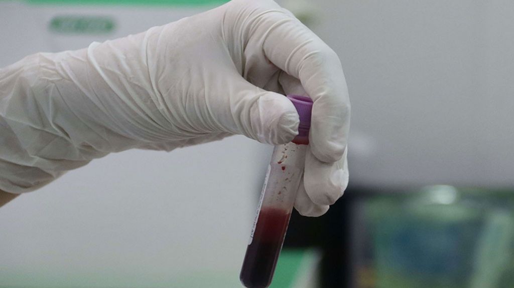  Investigan un gen que frena el Alzheimer con tendencia hereditaria 