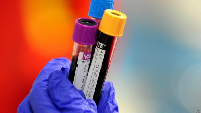 Expertos en salud estudian las causas de una "extraÃ±a enfermedad" en Nigeria