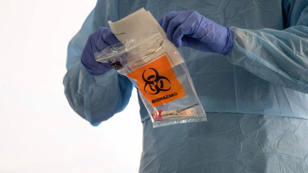  Aprobada por la FDA primera prueba r&aacute;pida de Covid-19 que est&aacute; lista en 45 minutos 