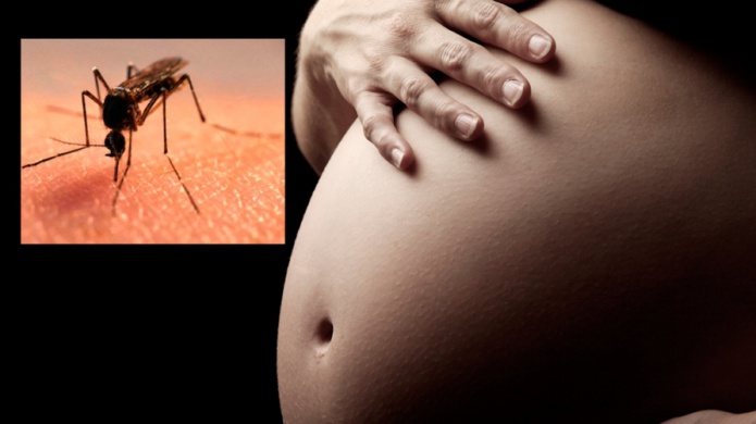 Primer caso de un embarazo en P.R. donde el feto demostrÃ³ microcefalia por el Zika 