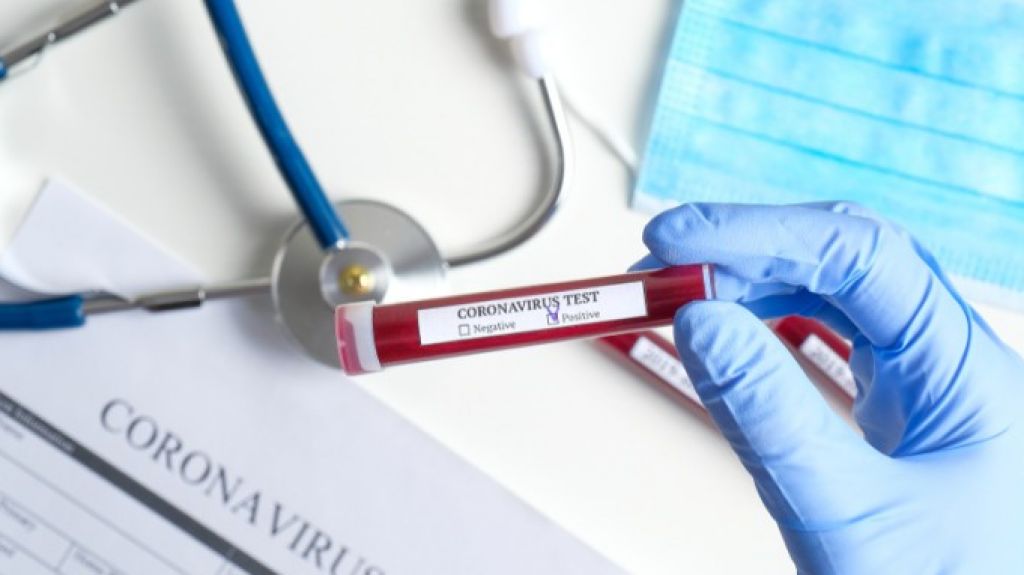  Muertes por COVID-19 se quedan en 97 y los positivos aumentan a 1,843 