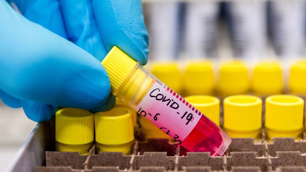  Aumentan las muertes de COVID-19 en la Isla a 24 