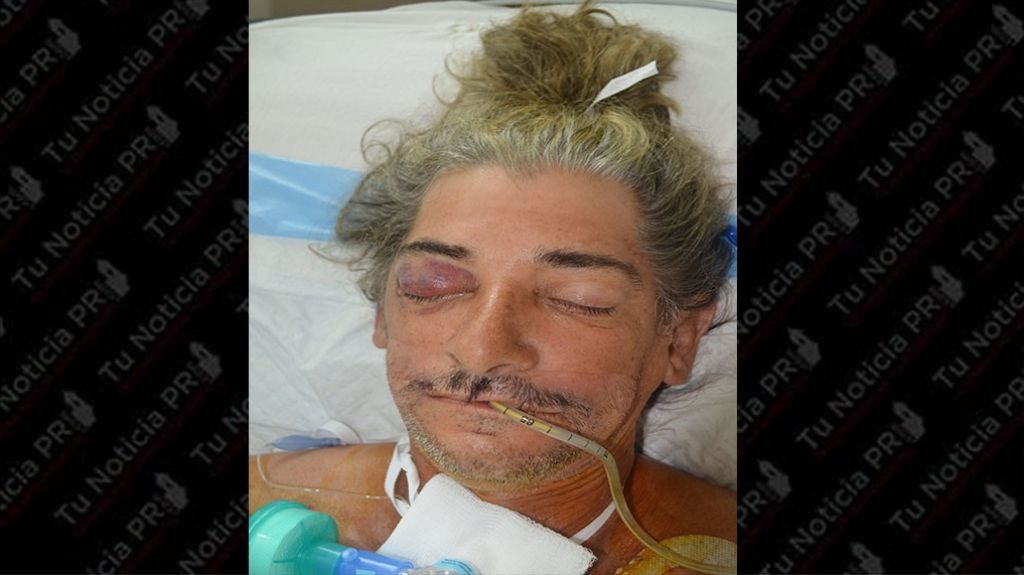  Sin identificar hombre recluido en Centro M&eacute;dico tras accidente 