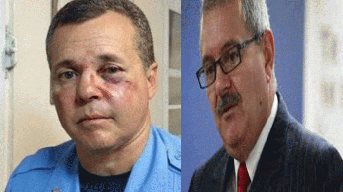 Continúa la desmoralización a los policías, Sargento victima de agresión ahora es investigado por la propia policía 