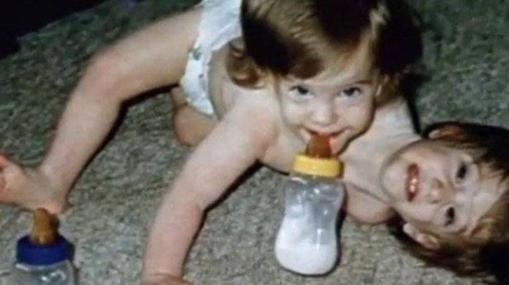  Fotos: Así lucen a sus 27 años las siamesas más famosas del mundo 