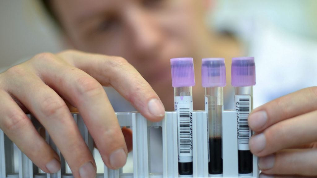  Descubren que prueba del papiloma detecta antes el cáncer de útero 