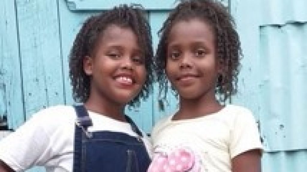  Exsiamesas separadas en 2011 cumplen 10 años de edad 