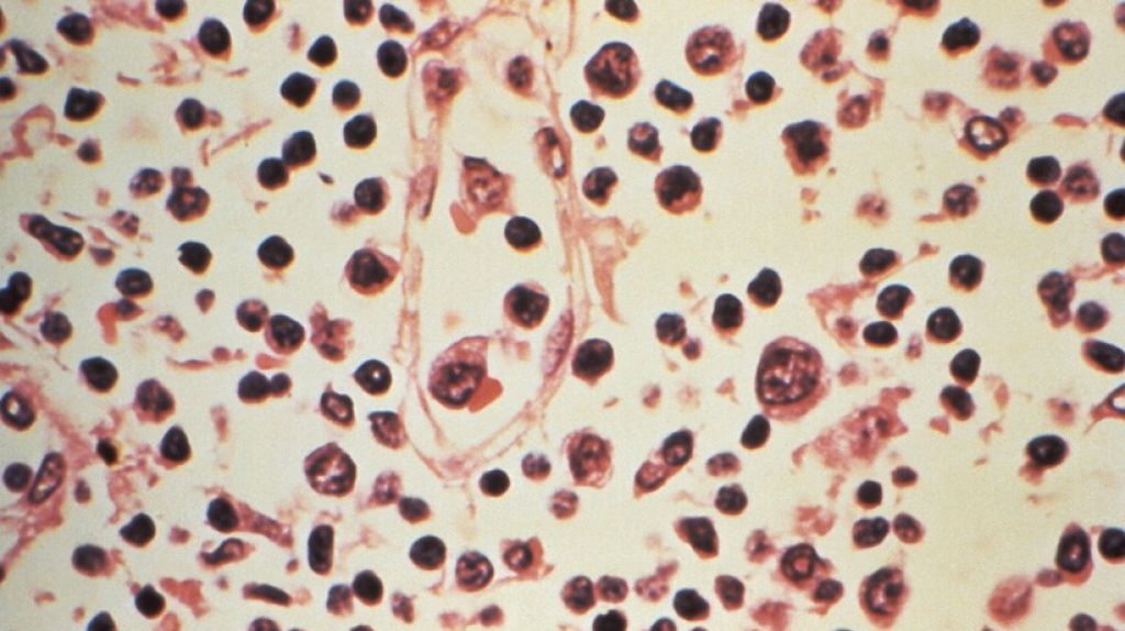  Se elevan a 12 las v&iacute;ctimas mortales por el brote de hantavirus en Argentina 