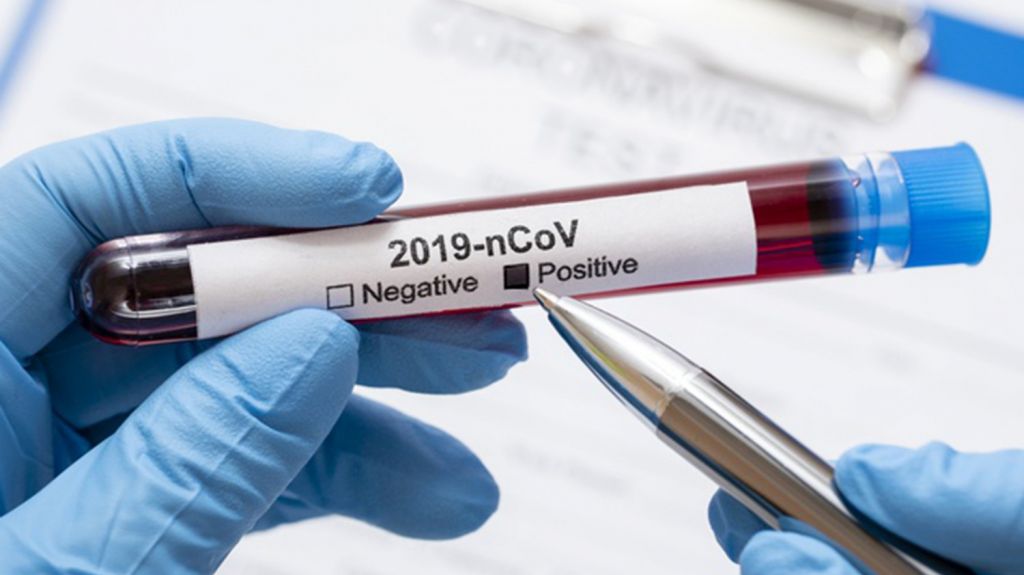  Se reporta una muerte y 17 casos &uacute;nicos positivos adicionales por COVID-19 en la isla 