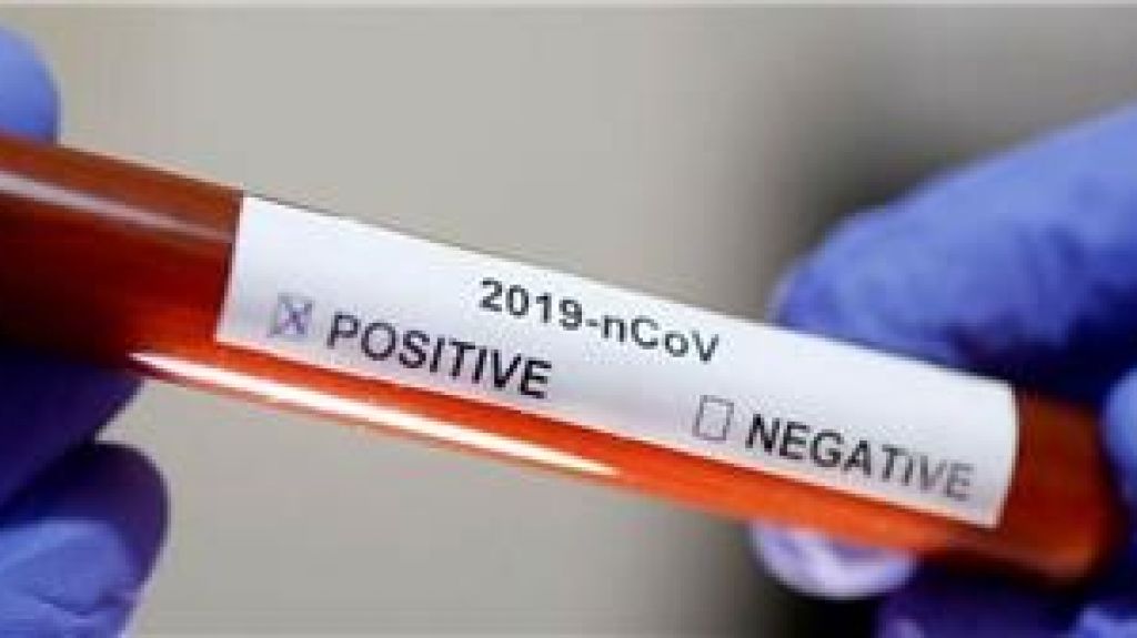  A partir de hoy todos los médicos con execuátur pueden indicar la prueba de coronavirus 