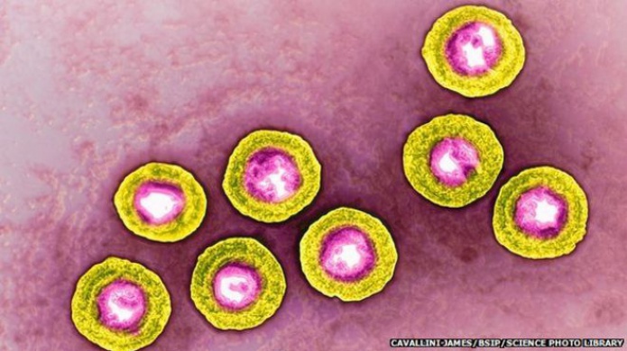 Virus del herpes labial para combatir el cÃ¡ncer de piel