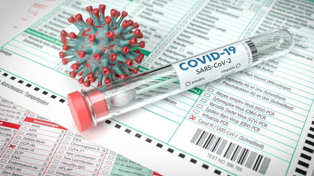  19 muertos, 382 casos positivos de COVID-19 en informe DS 