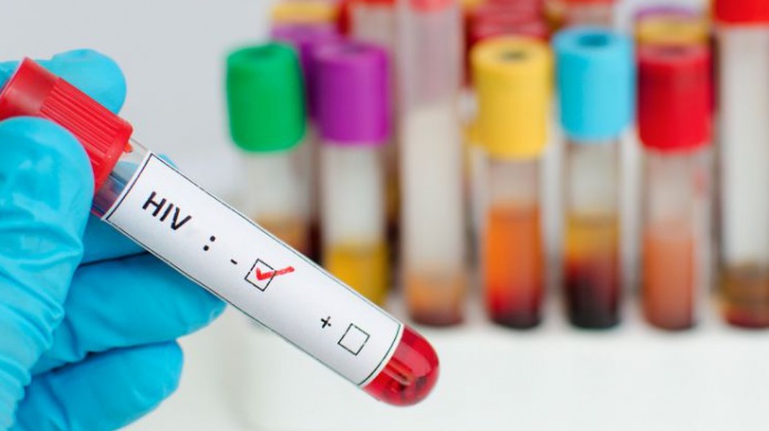 A participar del DÃ­a Nacional de Hacerse la Prueba de VIH