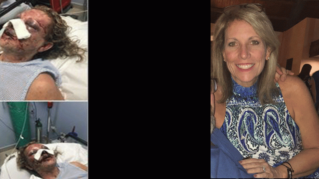  Video: Mujer resulta brutalmente golpeada durante sus vacaciones en Punta Cana 