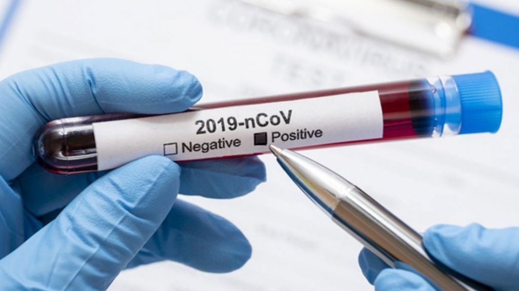  Se reportan tres muertes y 25 casos &uacute;nicos positivos adicionales por COVID-19 en la isla 