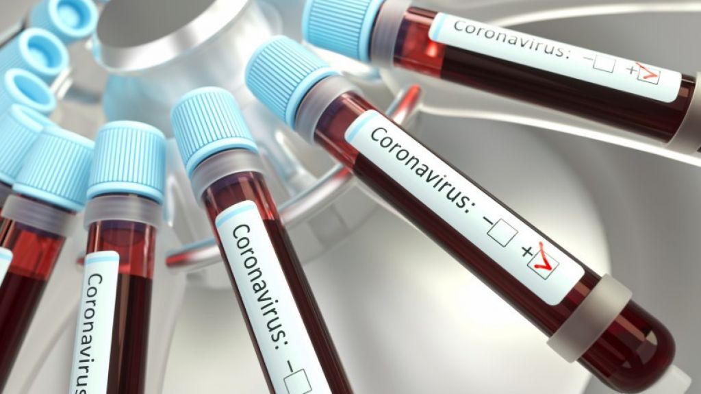  Suben a 18 los muertos por coronavirus en Puerto Rico 