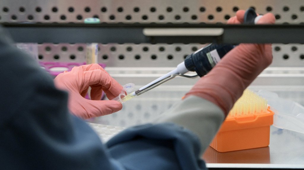  El caso único de “la paciente de Buenos Aires“ que controla el VIH desde hace 12 años 