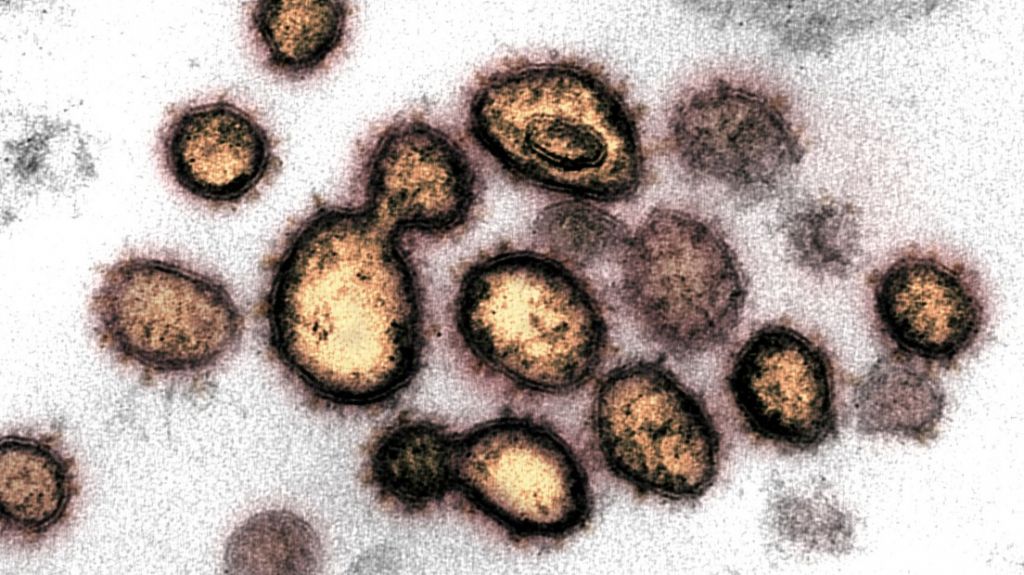  Cient&iacute;ficos explican c&oacute;mo el coronavirus se camufla cual "lobo con piel de cordero" para enga&ntilde;ar a nuestro organismo 