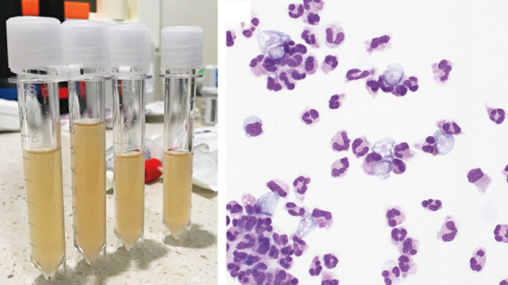  Muere un ni&ntilde;o tras infectarse con una ameba &ldquo;comecerebros&ldquo; al visitar un parque acu&aacute;tico de Texas (VIDEO) 