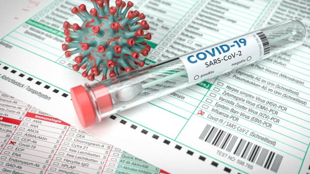  Salud reporta hoy 17 muertes por COVID-19 