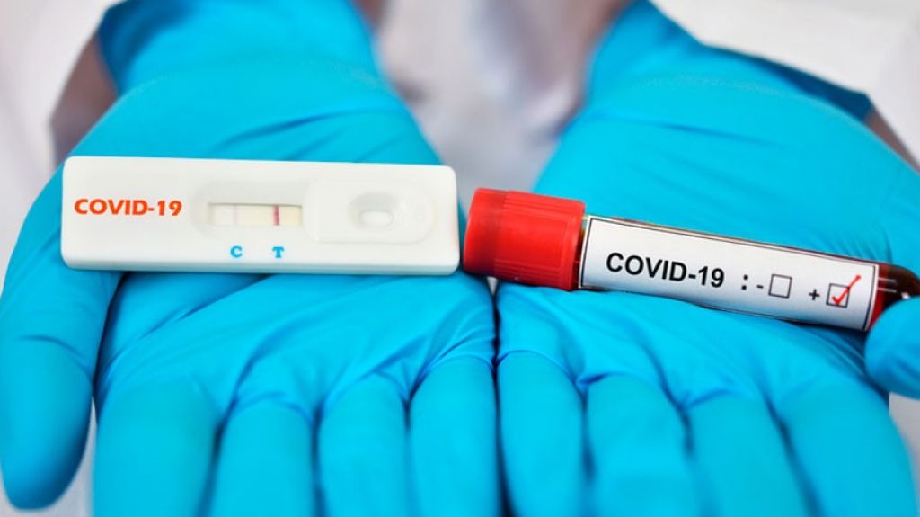  Coronavirus/Descubierta una madeja de intrigas para defraudar al gobierno de Puerto Rico con las pruebas diagn&oacute;sticas serol&oacute;gicas 